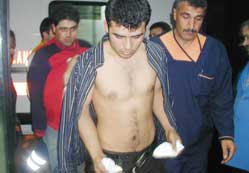 Döküm ocağında patlama: 2 yaralı