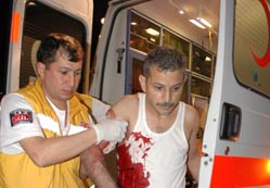 Çocuğunu görmek isterken bıçaklandı