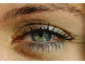 Glokom 50 yaş üzerini vuruyor