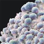 Prostat için yeni tedavi yöntemi