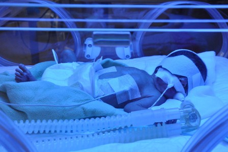 Anne karnındaki tek yumurta ikizine "literatürlük" müdahale