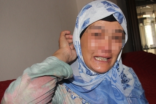 Bu kadının vücudundan sinek çıkıyor