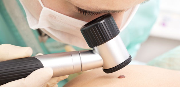 Vücudunda fazla beni olanlar dikkat!