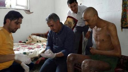 Suriyeli işkence mağdurları Konya’da tedavi ediliyor