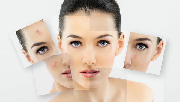 Cildinizle ilgili merak ettikleriniz bu haberde...