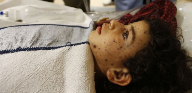 Gazze'de katliam sürüyor