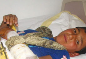 Kangren olmaktan son anda kurtuldu