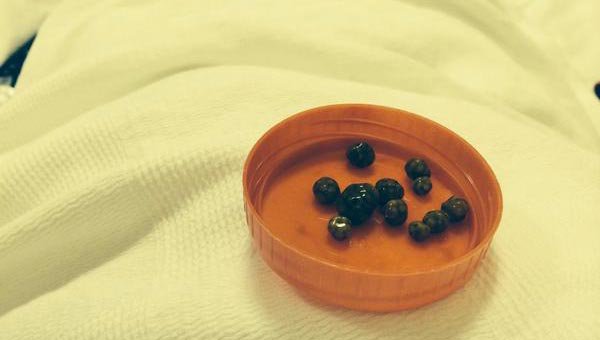 Bunlar ünlü şarkıcı Alişan'ın vücudundan çıktı