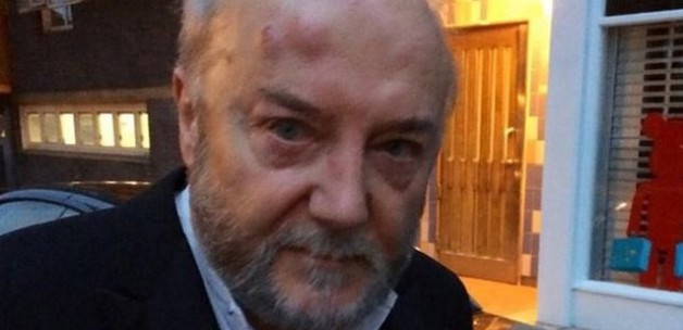 Milletvekiline 'İsrail' dayağı