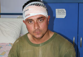 Akılalmaz kaza genci hastanelik etti