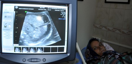 Anne karnındaki bebeğe iki milimetrelik damardan hayat operasyonu