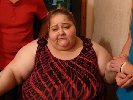 Obezite hastası kadın zayıflamak istiyor!!!