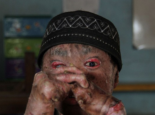 Yılan çocuk görenleri dehşete düşürüyor!