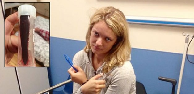 İnanılmaz ama gerçek! Burnundaki sülükle 1 ay yaşadı