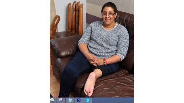 Akılalmaz Hata! Ayağını Ters Diktiler