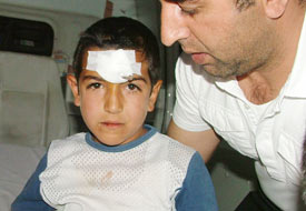 Çocuğun alnına inşaat çivisi saplandı