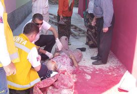 Boya yaparken merdivenden düştü