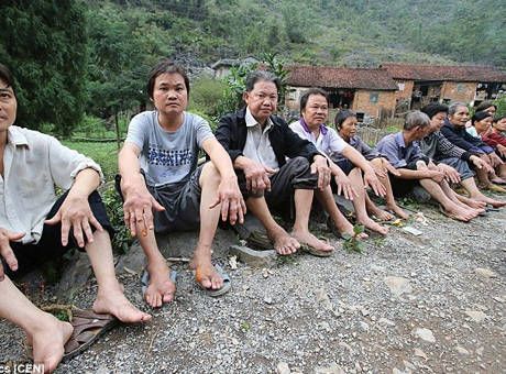 Doktorlar bile ne olduğunu çözemedi