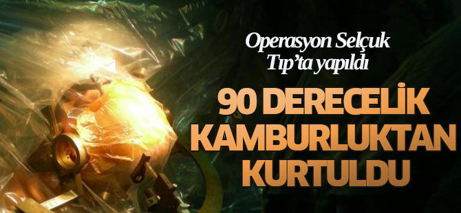 Beyin pili ile 90 derecelik kamburluktan kurtuldu