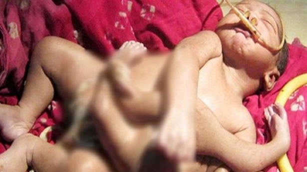 Bu bebek hastanede izdihama neden oldu!