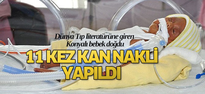 Dünya tıp literatürüne giren Konyalı bebek doğdu