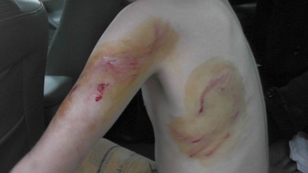 Köpeğin ısırdı hastanelik oldu