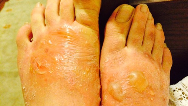 Bakanlık açıkladı: İşte zehirli ayakkabıların markası