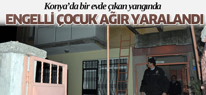 Engelli Çocuk Yangında Ağır Yaralandı