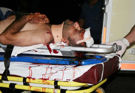 Beyşehir'de kaza: 2 yaralı