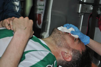 Ali Çamdalı'nın burnu kırıldı