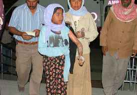 Üzerine kaynar su döküldü