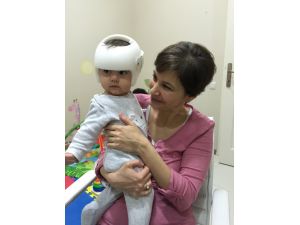 Bebeklerde Kafatası Şekil Bozukluklarına "Kask"lı Çözüm