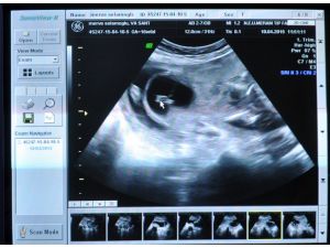 Merve Öğretmen, Bebeğine Kıyamadı