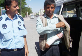 20 yıl önce yanan kolu ile dileniyor