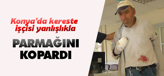 Çalışırken çekiçle kazara parmağını kopardı