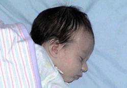 Erken sütten kesme zararlı