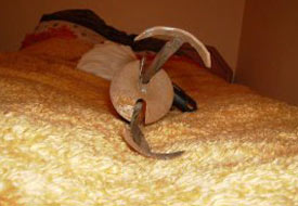 Köstebek tuzağı parmak kopardı