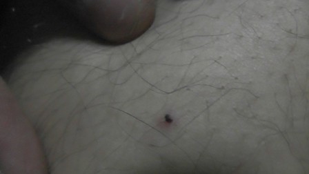 Kulu’da kene vakaları çoğaldı