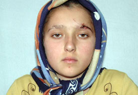 Yaralı kurtulan Merve yaşadıklarını anlattı