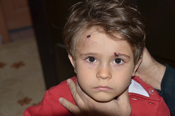 Sokak köpekleri 3 yaşındaki çocuğu yaraladı