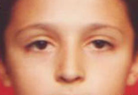 Yaralı Burak kurtarılamadı