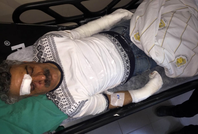 HDP'yi eleştiren Kürt sanatçı Mehmet Karakuş saldırıya uğradı