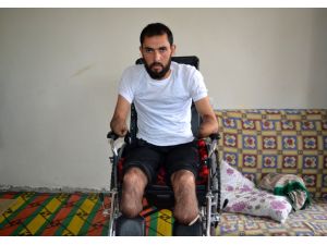 El ve ayaklarını kaybeden Suriyeli genç protez bekliyor