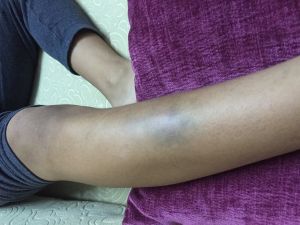 Bursa'da öğretmenin öğrenciyi darbettiği iddiası