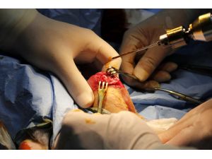 MKÜ'den vücutta eriyebilen implant