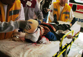 Gübre kavgasında çocuk yaralandı