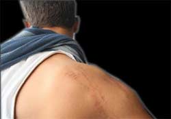 'Benim ve yeğenimin ağzına jop soktular'