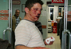 Ormanlık alanda darp edildiler