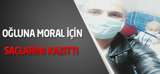 Oğluna moral için saçlarını kazıttı