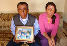 Onlar için en büyük tehlike güneş